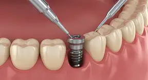 Restorative Dentistry